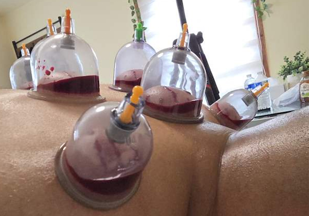 Preparing for Your First Hijama Appointment