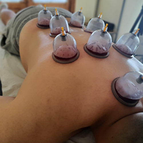 wet-cupping-new